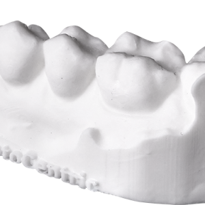 UV-Laser-Dental-Model